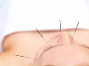 acupuncturefacelift.jpg